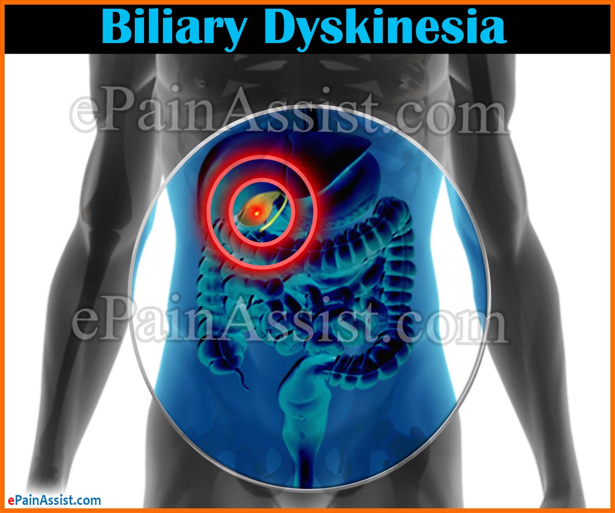 Biliary Dyskinesia