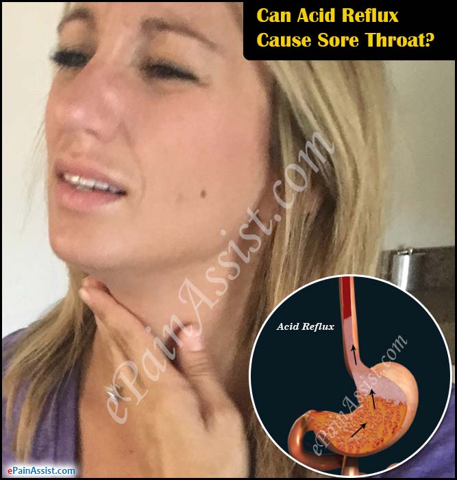 Acid reflux sore throat gargle