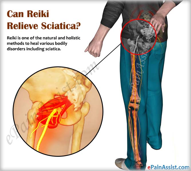 Can Reiki Relieve Sciatica?