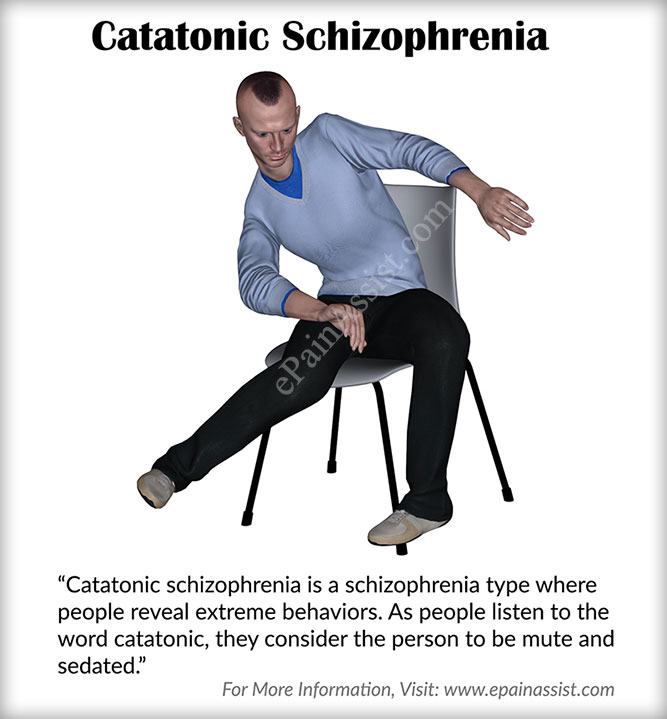 Catatonic Schizophrenia