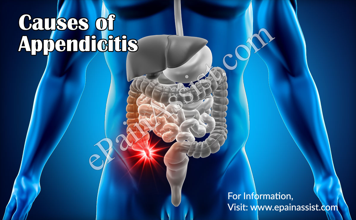Causes and Risk Factors of Appendicitis Causes and Risk Factors of Appendicitis