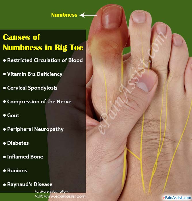 Causes of Numbness in Big Toe