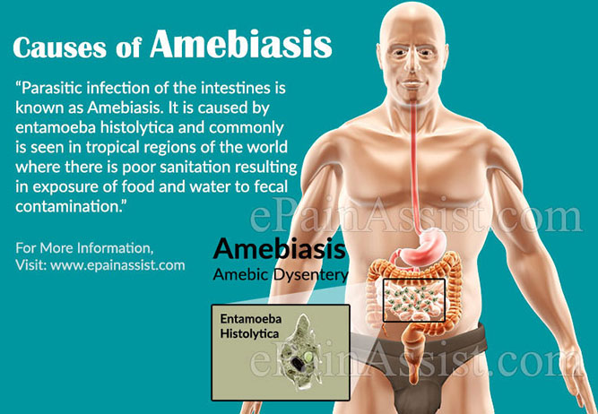 Causes of Amebiasis