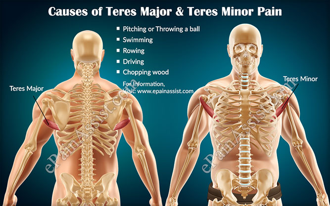 Causes of Teres Major and Teres Minor Pain Causes of Teres Major and Teres Minor Pain