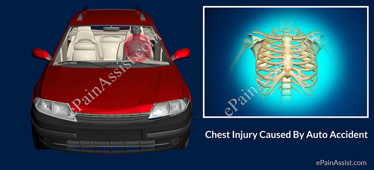 Chest Injury Caused By Auto Accident