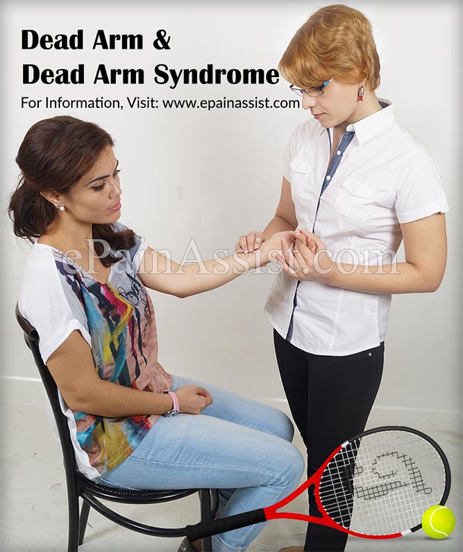 Dead Arm & Dead Arm Syndrome