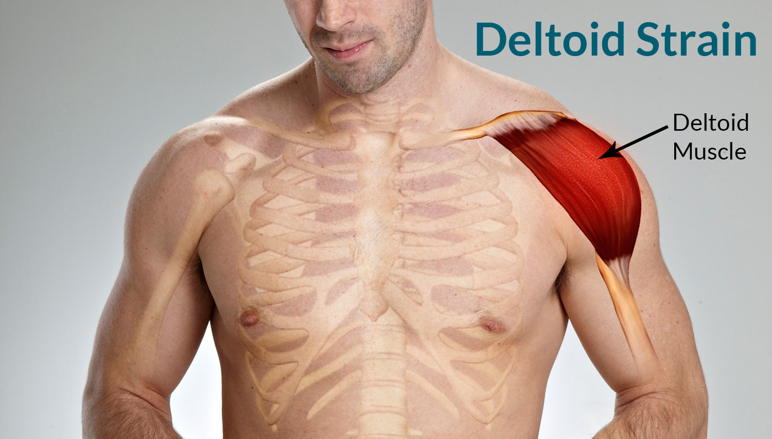Deltoid muscle Pain