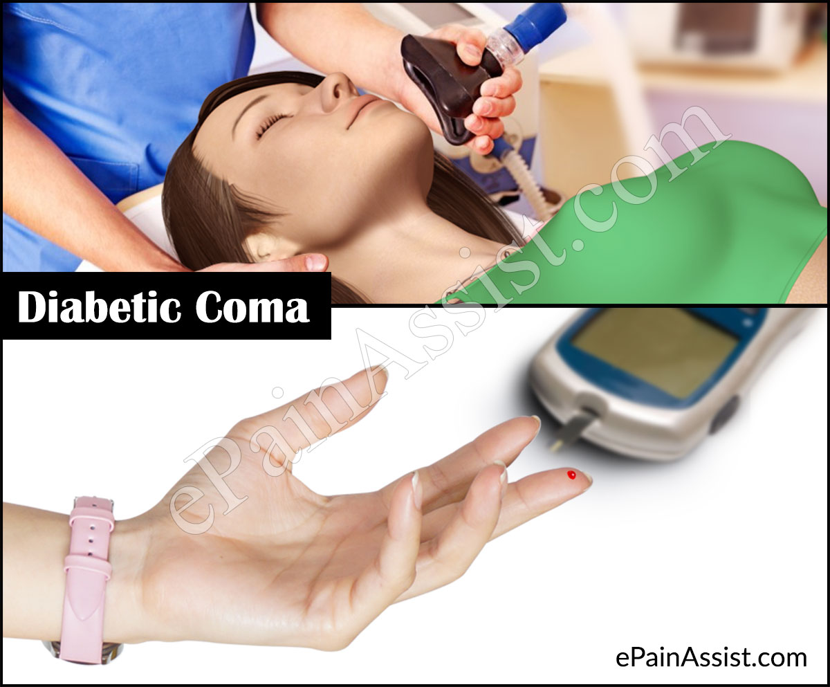 What is Diabetic Coma and What Happens When You go Into a Diabetic Coma?