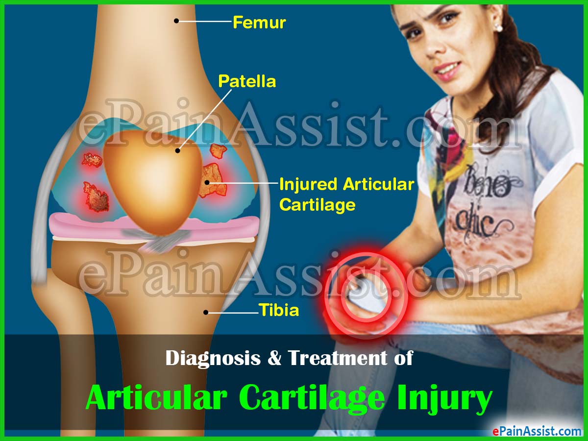 Diagnosis & Treatment of Articular Cartilage Injury Diagnosis & Treatment of Articular Cartilage Injury