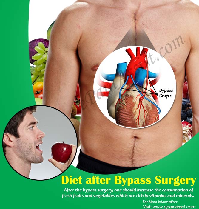 Diet after Bypass Surgery