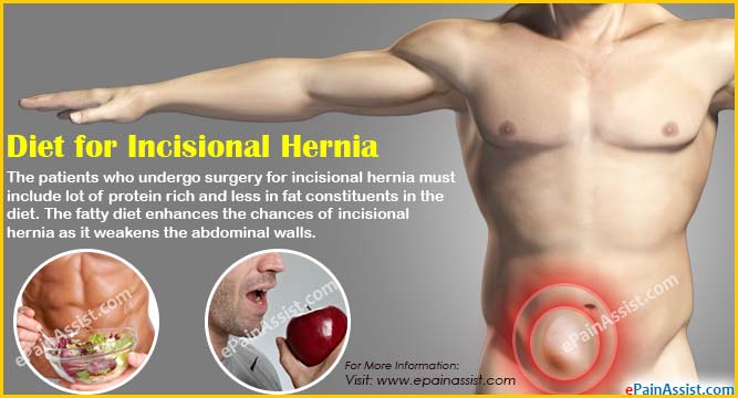 Diet for Incisional Hernia