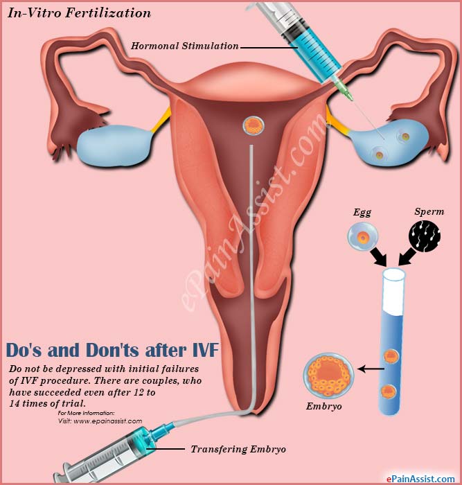 Do S Don Ts After Iui And Ivf