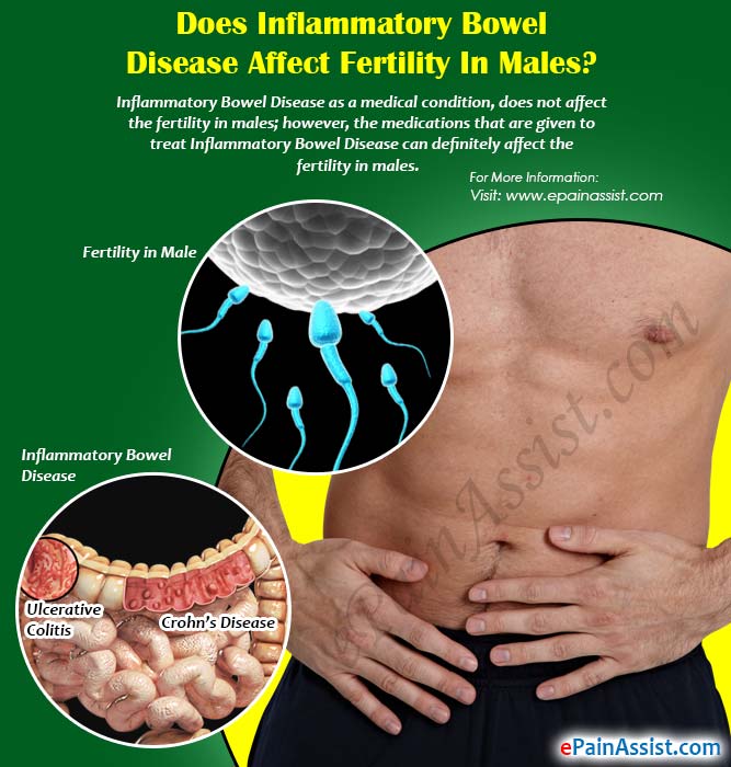 Does Inflammatory Bowel Disease Affect Fertility in Males?