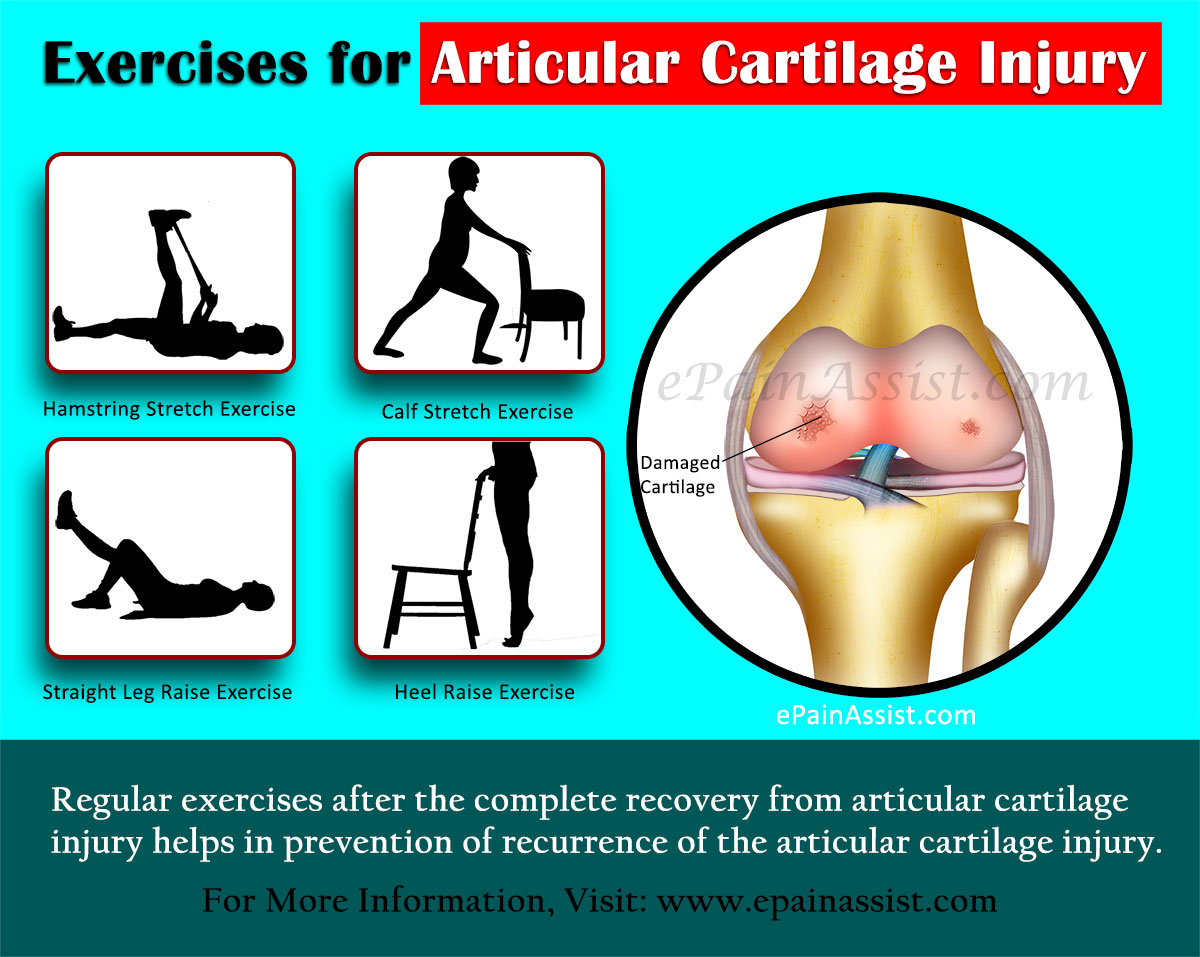 Exercises for Articular Cartilage Injury Exercises for Articular Cartilage Injury
