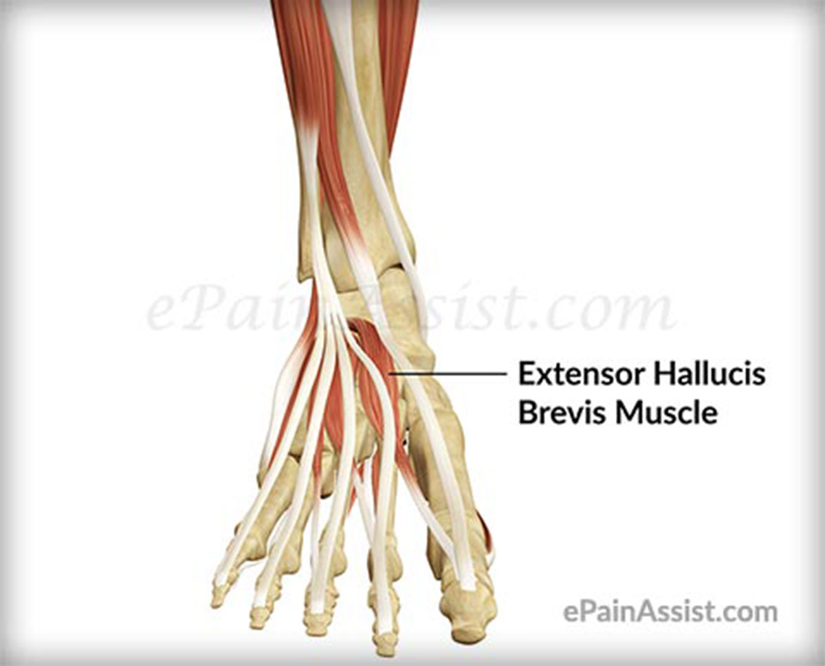 Extensor Hallucis Brevis Muscle Strain Extensor Hallucis Brevis Muscle Strain