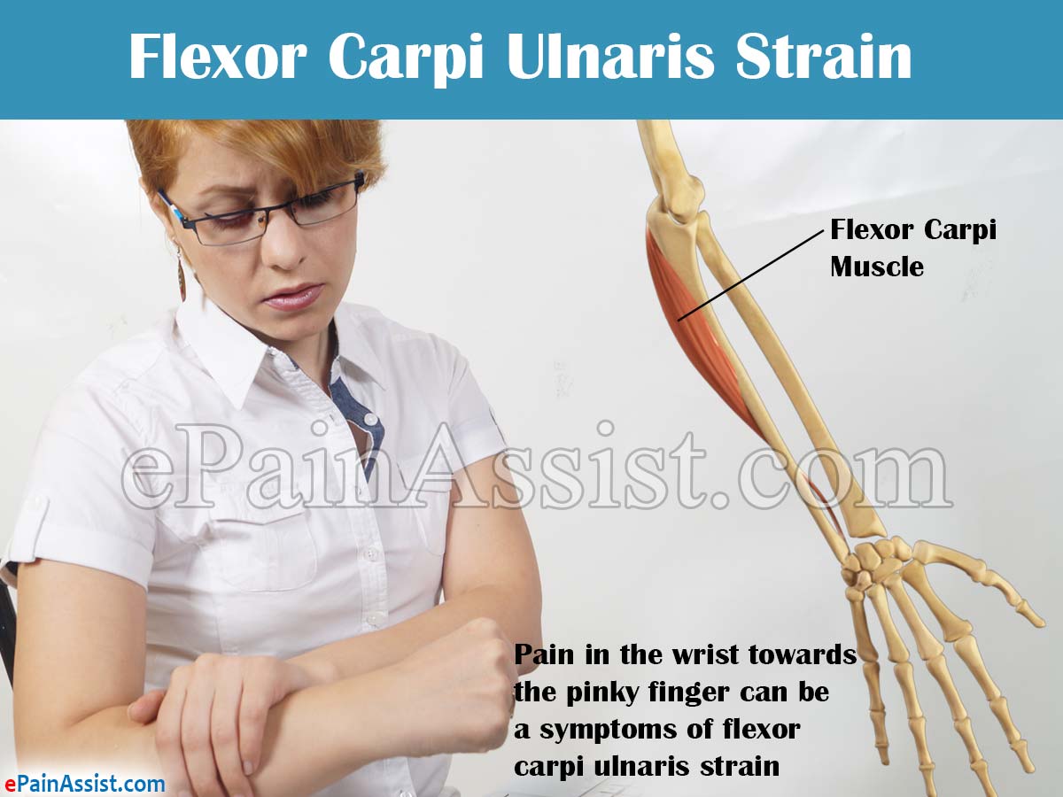 Flexor Carpi Ulnaris Strain Flexor Carpi Ulnaris Strain