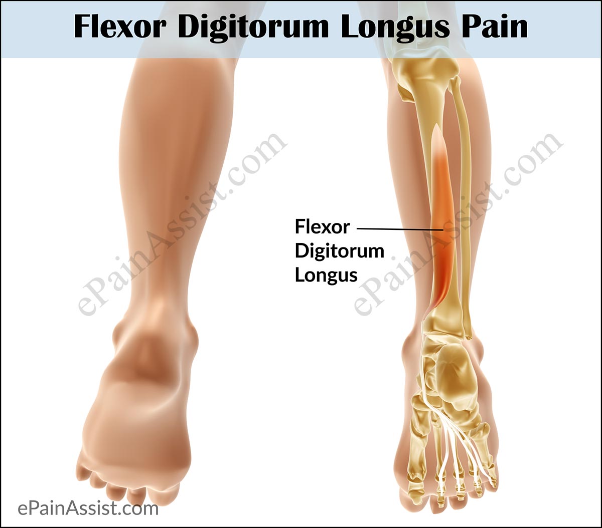 What is Flexor Digitorum Longus Muscle