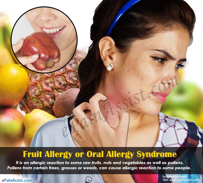 Fruit Allergy or Oral Allergy Syndrome Fruit Allergy or Oral Allergy Syndrome