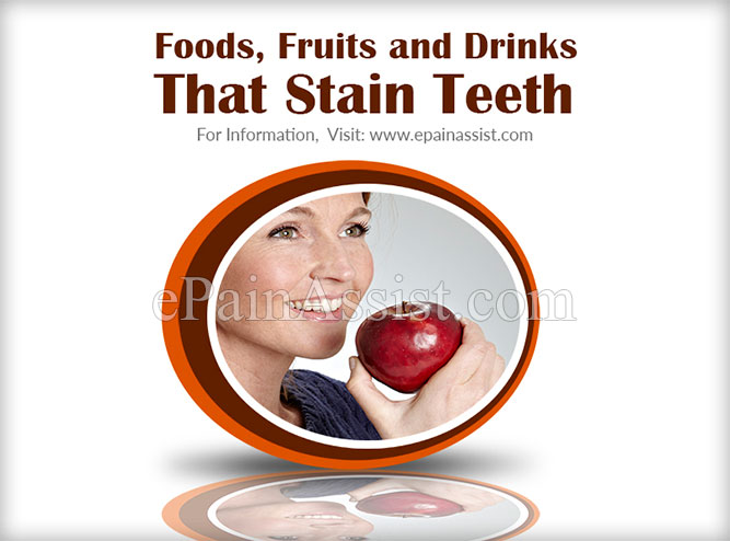 Foods, Fruits and Drinks That Stain Teeth