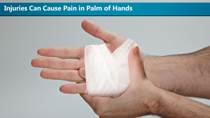 causes-of-pain-in-palm-of-hands