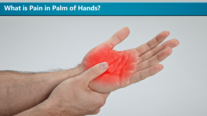 what-is-pain-in-palm-of hands