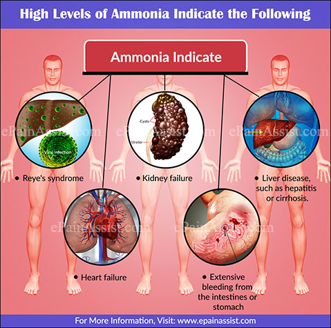 What Does Ammonia Level Indicate?