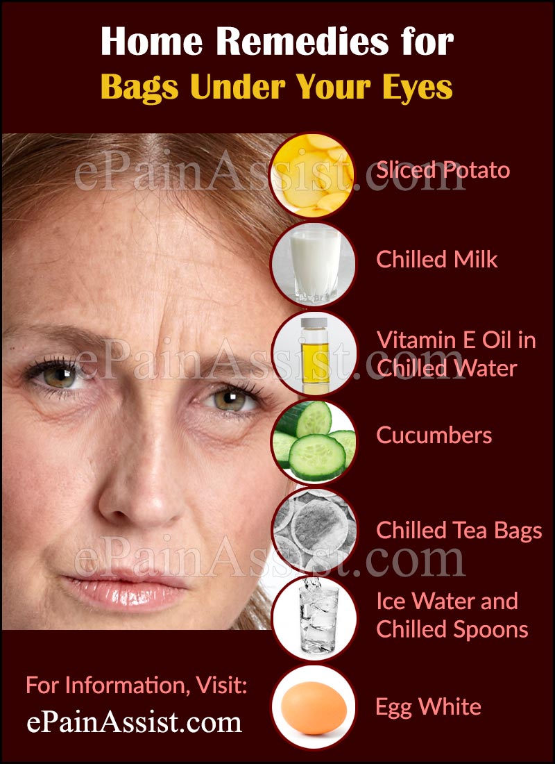 Home Remedies for Bags Under Your Eyes