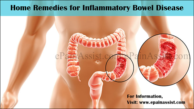 What are the Home Remedies for Inflammatory Bowel Disease