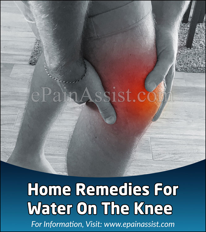 Home Remedies For Water On The Knee Or Knee Effusion