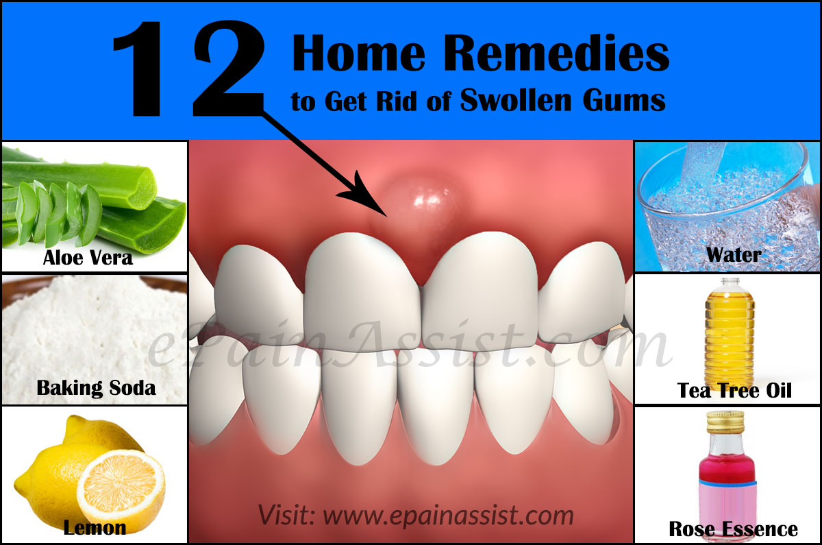 What Causes Swollen Gums And Home Remedies To Get Rid Of It