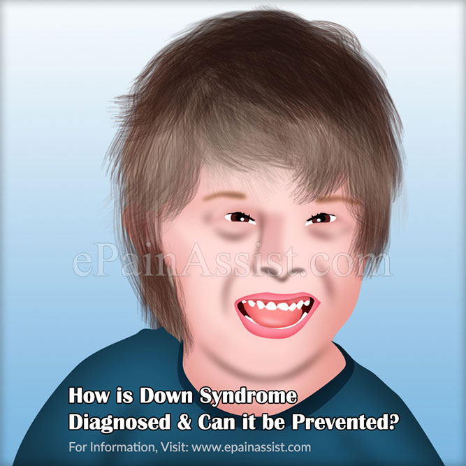 How is Down Syndrome Diagnosed & Can it be Prevented?