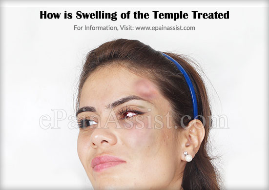 How is Swelling of the Temple Treated?