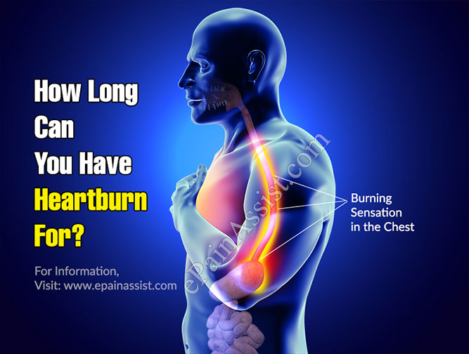 How Long Can You Have Heartburn For?