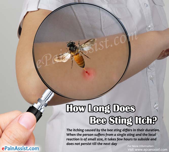 How Long Does Bee Sting Itch?