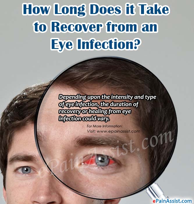 How Long Does it Take to Recover from an Eye Infection?