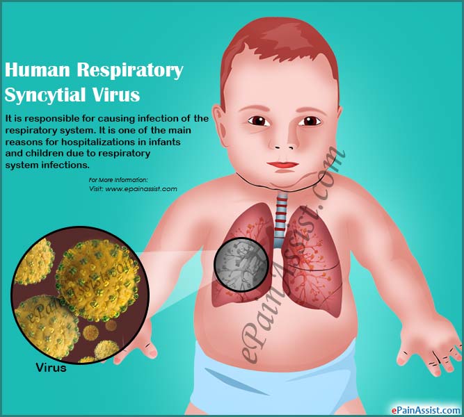 Human Respiratory Syncytial Virus or RSV