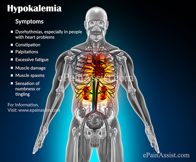 Hypokalemia