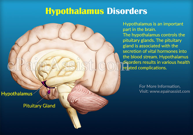 Image result for inflamed hypothalamus