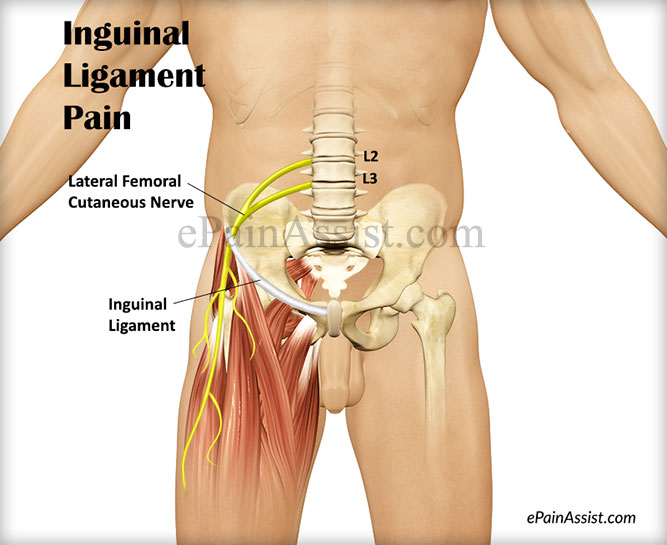 Inguinal Ligament Pain