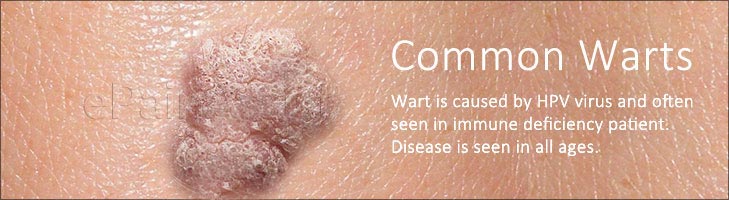Alternative Treatments For Allergy Sufferers
