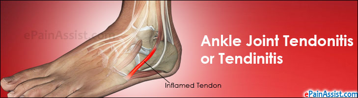Ankle Joint Tendonitis or Ankle Joint Tendinitis