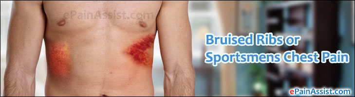 Bruised Ribs or Sportsmen’s Chest Pain|Causes|Risk Factors|Symptoms