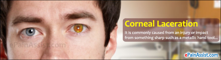 home remedies for corneal abrasion