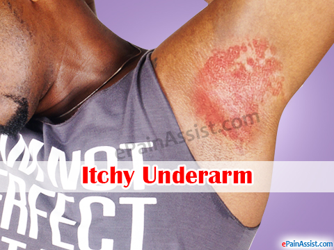 Itchy Underarms or Itching in Armpits