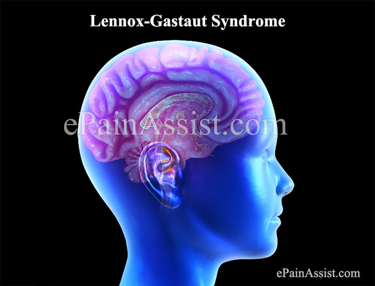 Lennox-Gastaut Syndrome Lennox-Gastaut Syndrome