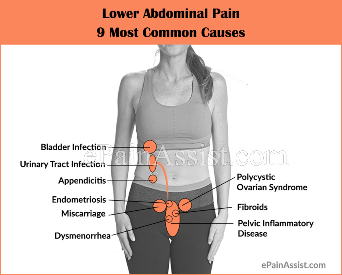 9 Most Common Causes, Symptoms, Investigations and Treatment for Lower Abdominal Pain