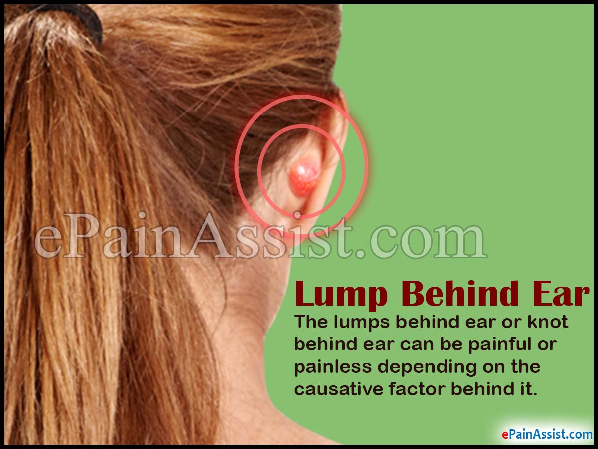 Lump Behind Ear or Knot Behind Ear