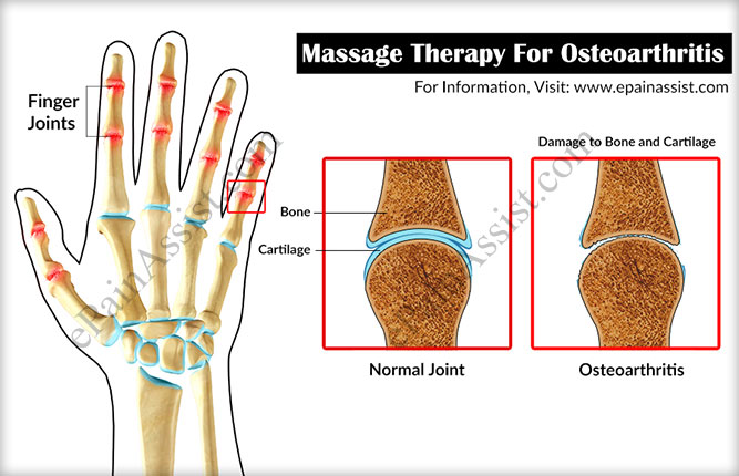 Massage Therapy For Osteoarthritis