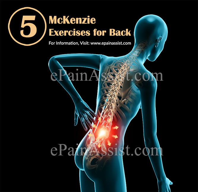 5 McKenzie Exercises for the Back 5 McKenzie Exercises for the Back
