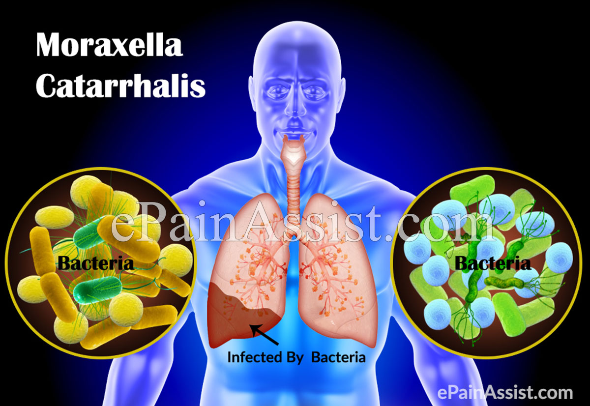 Moraxella Catarrhalis